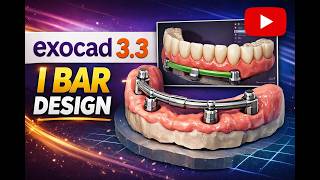 Exocad 3.3 I-Bar Design Tutorial 🔥 Step-by-Step Implant Bar Design | Full Workflow