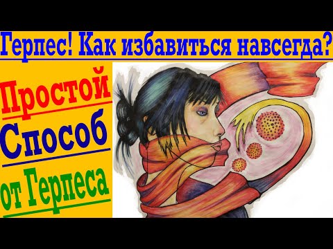 Простой способ ИЗБАВИТЬСЯ ОТ ГЕРПЕСА НАВСЕГДА !