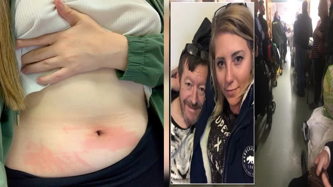 Student Allergic To Her Own Tears Suffers Cuts On Tongue When She student-allergic-to-her-own-tears-suffers-cuts-on-tongue-when-she