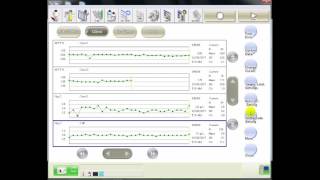 CS2000i - Hien thi bieu do QC
