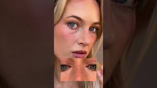 Freckles Or No Freckles..