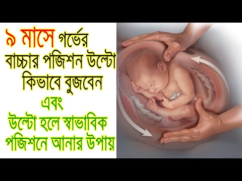 ভিডিও: এক্সিকিউটিভ পজিশন: ভালো -মন্দ