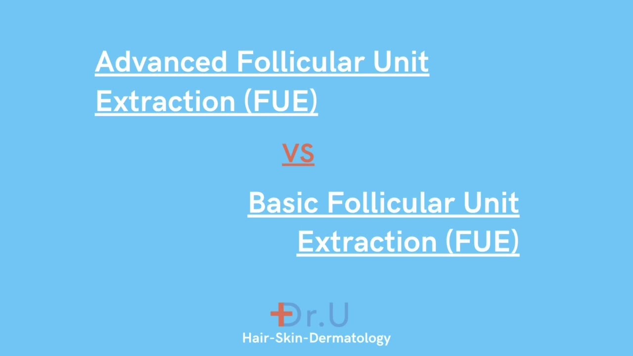 Basic FUE Hair Transplant Verses Advanced FUE Hair Transplant