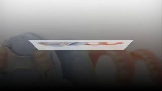 Kissimmee Dentures - 407-847-0100