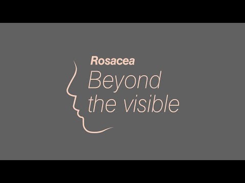 Experten klären auf – Krankheitsbelastung bei Rosacea