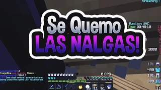 Adrianfire Se Quema Las Nalgas V