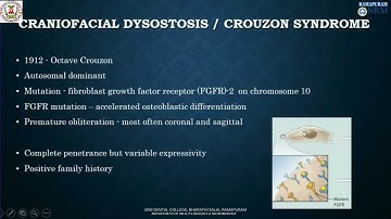 Crouzon Syndrome - Craniofacial Dysostosis Divya B - Department of oral Pathology & Microbiology