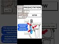 Overview Of Wolff Parkinson White WPW Syndrome Overview Of Wolff Parkinson White WPW Syndrome