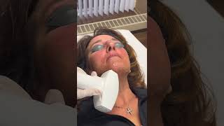QUICK LASER HAIR REMOVAL COMPILATION! #laserhairremoval #skincare #shorts