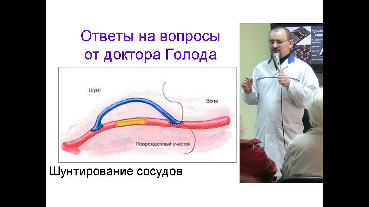 Шунтирование сосудов и применение оборудования Нуга Бест - YouTube