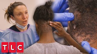 Dr. Emma Treats Jelani's Mysterious Pus-Filled Bumps | Save My Skin