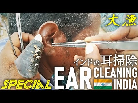 大漁・路上耳かき耳掃除 in インド Ear Cleaning India ASMR