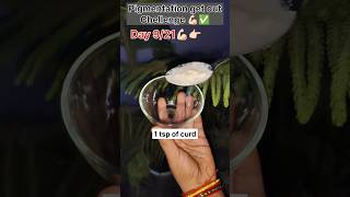 Pigmentation get out chellenge day9/21💪🏻#shorts #shortvideo #pigmentation #tips #skincare #trending