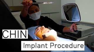 Chin Implant Procedure FT. William Arthur