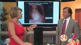 Mayo Clinic talks advancements in pacemakers, defibrillator technology