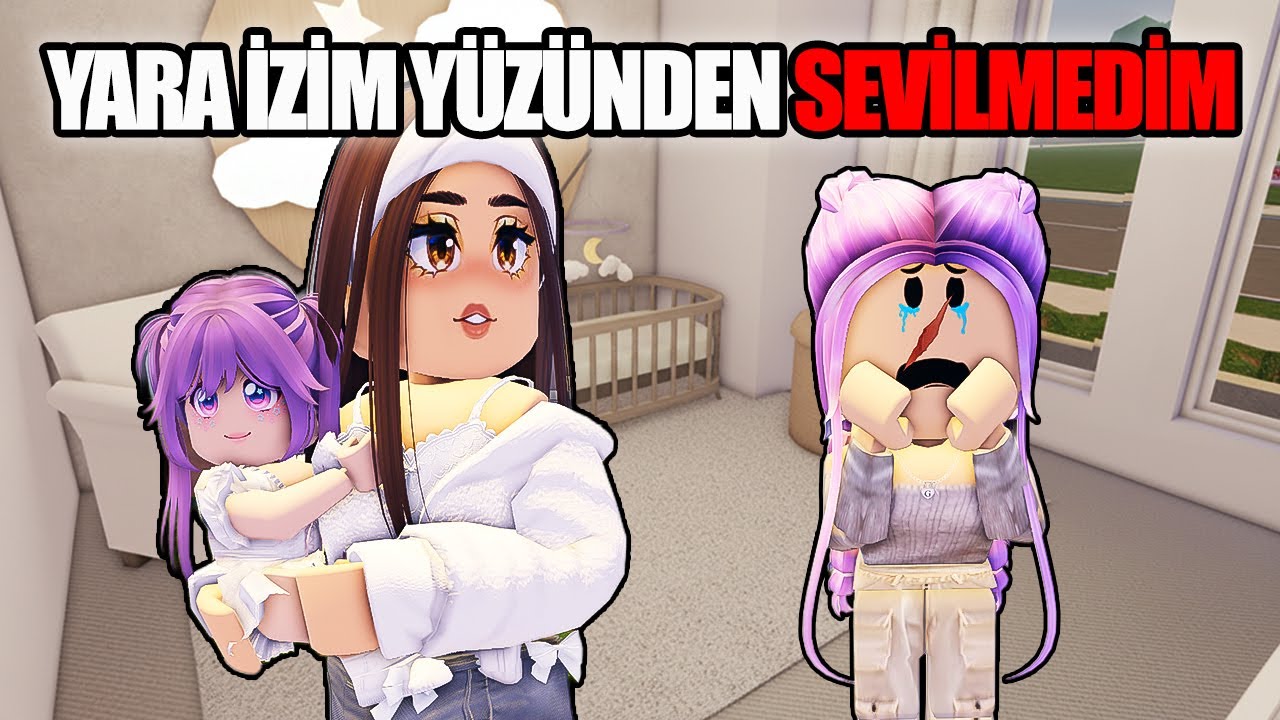 👉Hikaye: Yara İzim Yüzünden Sevilmedim...😨