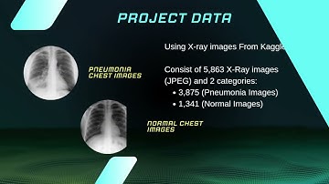 GDIID 2023 | ID 4092:  PNEUMONIA DETECTION SYSTEM USING CONVOLUTIONAL NEURAL NETWORK