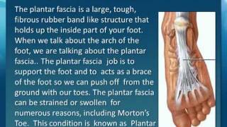 Plantar Fasciitis Explained By Foot Care Podiatrist Of Panama City Fl