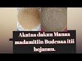 Kotaa Akataa Budenaa Dakuu Manaa Madamitiin Hojataani Ilalaa ЁЯШАЁЯШК Kotaa Akataa Budenaa Dakuu Manaa Madamitiin Hojataani Ilalaa ЁЯШАЁЯШК