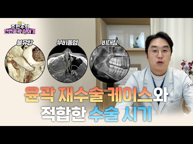 안면윤곽 재수술 가능한 시기는?! [불유합/부비동염/비대칭/불만족]