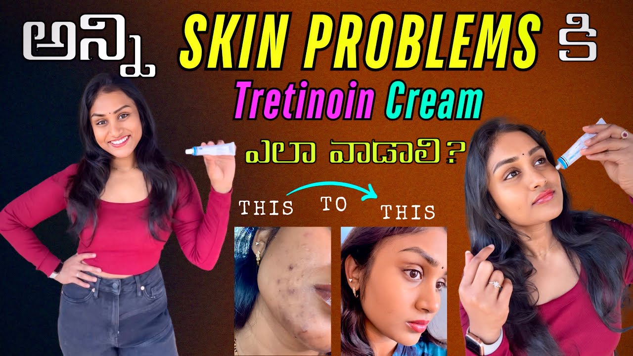 🚨అలా ఉండే Skin😨ఇలా అయ్యింది🤩అన్ని Skin problems కి ఈ Cream ఏ Solution🤩 #tretinoin #skincare #beauty