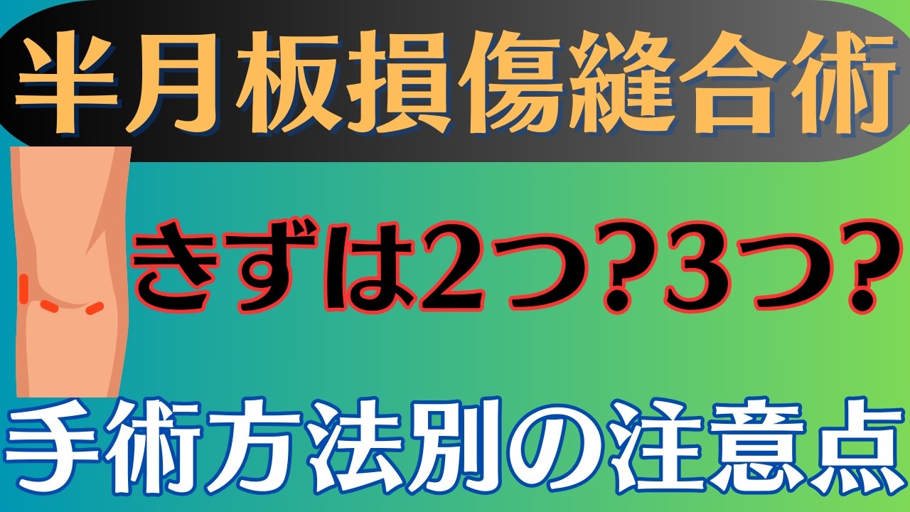 ポイント】半月板損傷縫合術 3つの手術方法とリハビリの注意点 - YouTube