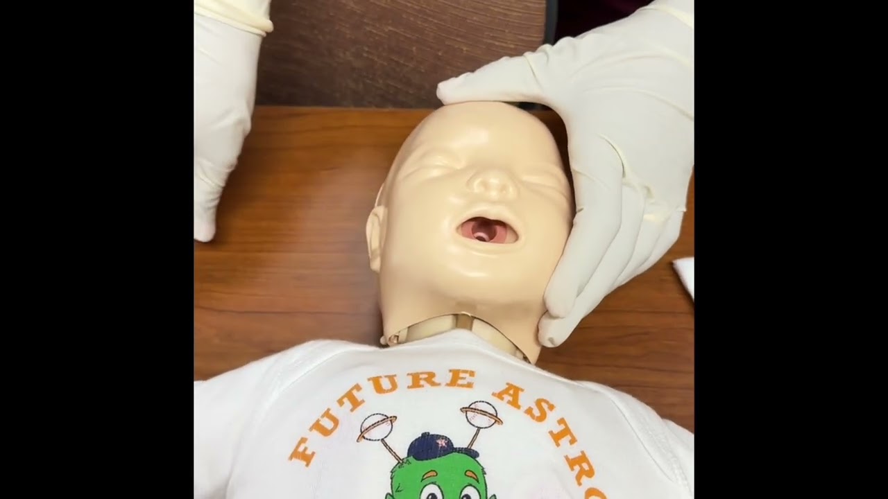 Glucose Gel administration in neonates