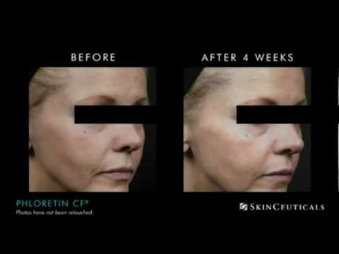 serum phloretin cf skinceuticals