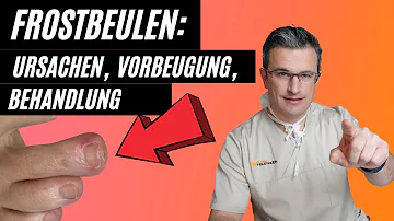 Wie sehen Frostbeulen an den Füßen aus?