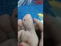 Acupressure point for brain 🧠
