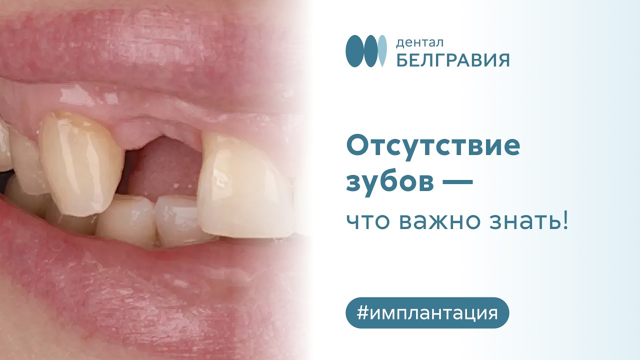 👉 Отсутствие зубов — что важно знать!