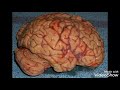 الرقية الشرعية علاج تلف خلايا الدماغ والمخ والمخيخ الرقية الشرعية علاج تلف خلايا الدماغ والمخ والمخيخ