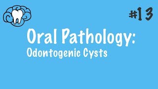 Oral Pathology | Odontogenic Cysts | INBDE, ADAT screenshot 5