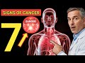 7 Signs of Cancer You Should Never Ignore