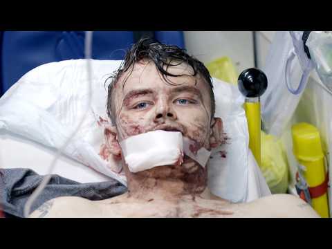 Teen Bleeds Out In Front Of Paramedics | Ambulance: Code Red Uncensored Full Episode S02 E09