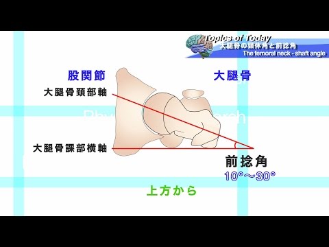 大腿骨の頸体角と前捻角 The femoral neck - shaft angle ：理学療法士による身体活動研究