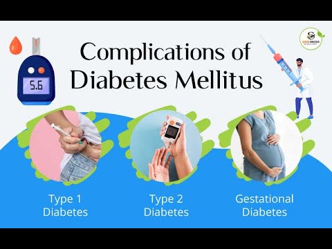 Diabetes Mellitus: Here are Symptoms, Treatment, and Types of Diabetes Mellitus You Should Know About