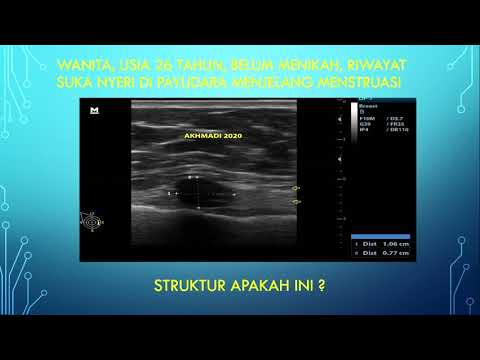 Video: Ultrasound Payudara: Tujuan, Prosedur, Dan Hasil