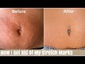 How To Get Rid Of Stretch Marks | This REALLY WORKED | Victoria Victoria