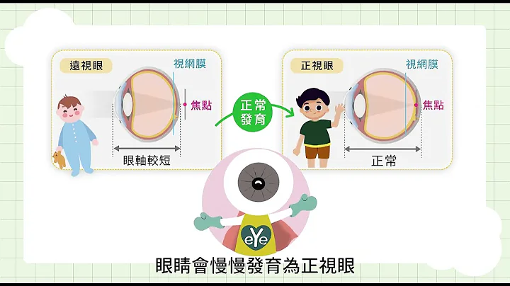 眼球超人小教室-近視防治懶人包 - 天天要聞