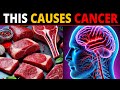 TOP 10 WORST Food that feed CANCER cells