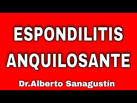 Vídeo: 7 Consejos Para Encontrar Un Reumatólogo Si Tiene Espondilitis Anquilosante