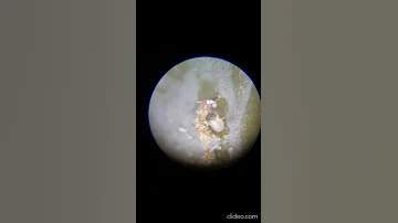 Вредители винограда: Гроздевая листовёртка - гусеница. Lobesia botrana (larvae)