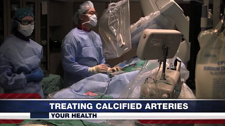 Calcified Artery Treatment, Dr. Arthur Lee, Dec 18, 2013, WCJB TV20 News