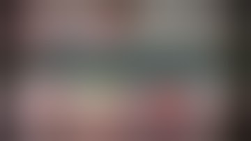 CataractCoach™1819: curriculum lesson 22: small pupil and iris prolapse