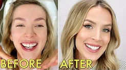 INVISALIGN | PAIN, COST, WAS IT WORTH IT? & EVERYTHING THEY DON'T TELL YOU, Houston Invisalign at Jennings Orthodontics, My Invisalign Journey: Advice from Houston and Chewies Review, Perfect Wedding Smile:Houston Invisalign Dentist Dr.Heather Brown, Invisalign Houston