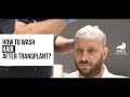 How to wash your hair after hair transplant  dr firdavs ahmedov  smile hair clinic