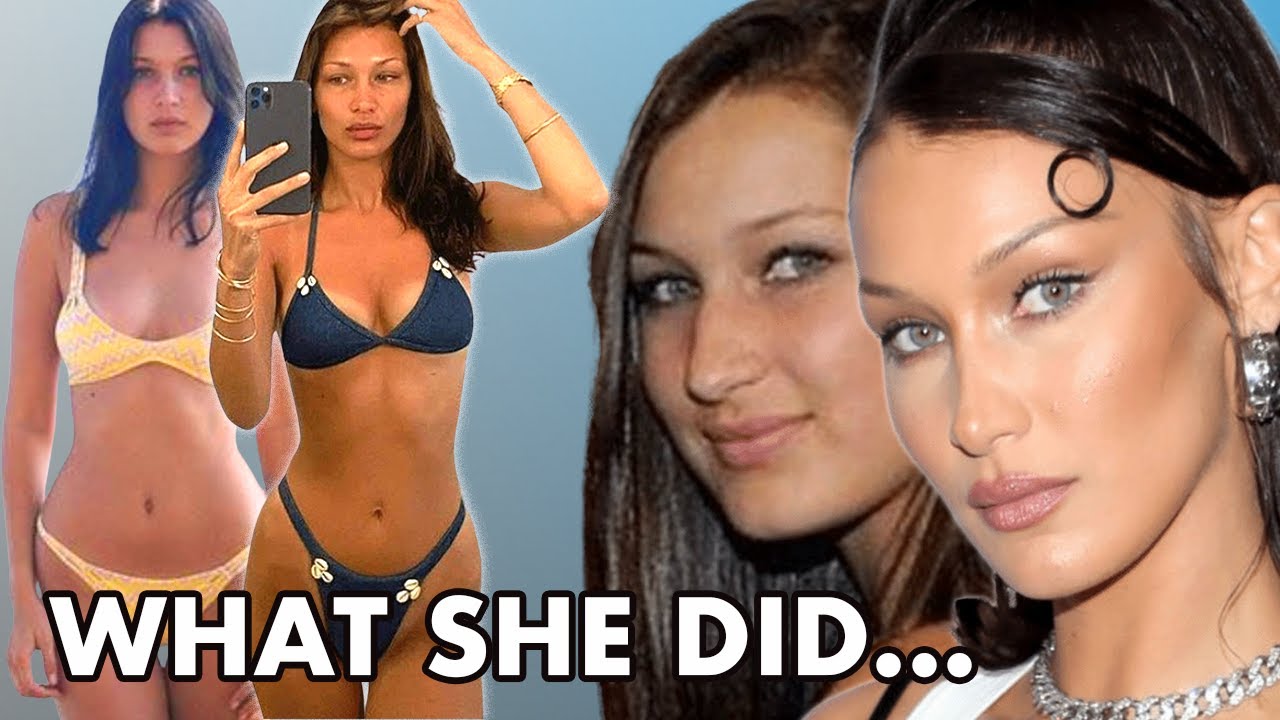 Bella Hadid Plastic Surgery Update (2021): Ponytail Face Lift And Body Procedures