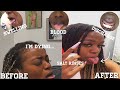 My tongue piercing healing process | day 1-7 | I almost took it out |