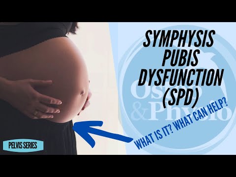 Video: Symphysis Pubis Dysfunktion: Symptome, Behandlung, Risiken Und Mehr
